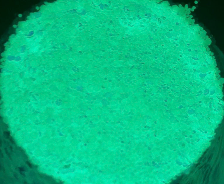 Miami Vice green glow in the dark chunky mix glitter