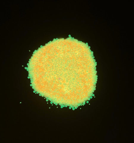 The Antioxidant orange glow in the dark chunky mix glitter