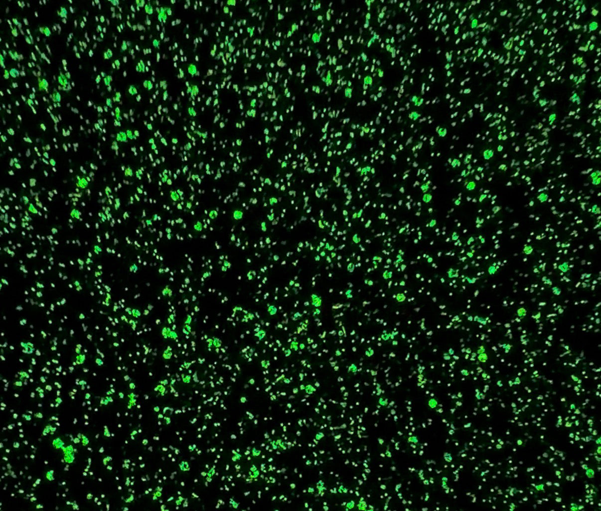 World's Greatest Husband green glow in the dark chunky mix glitter